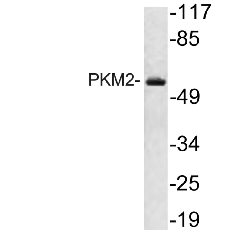 Western Blot - Anti-PKM2 Antibody (R12-2313) - Antibodies.com