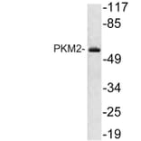 Western Blot - Anti-PKM2 Antibody (R12-2313) - Antibodies.com