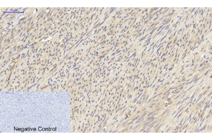 Immunohistochemistry - Anti-PKM2 Antibody (R12-2313) - Antibodies.com