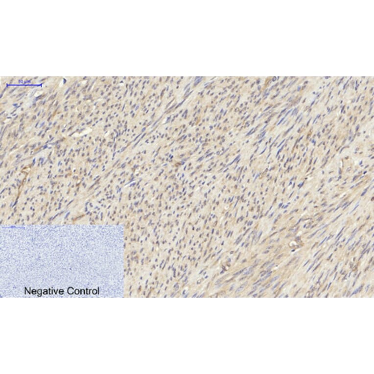 Immunohistochemistry - Anti-PKM2 Antibody (R12-2313) - Antibodies.com