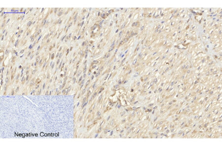 Immunohistochemistry - Anti-PKM2 Antibody (R12-2313) - Antibodies.com