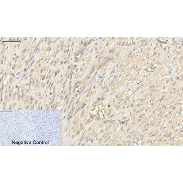 Immunohistochemistry - Anti-PKM2 Antibody (R12-2313) - Antibodies.com
