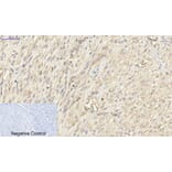 Immunohistochemistry - Anti-PKM2 Antibody (R12-2313) - Antibodies.com