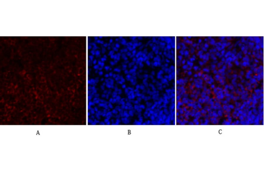 Immunofluorescence - Anti-PKM2 Antibody (R12-2313) - Antibodies.com