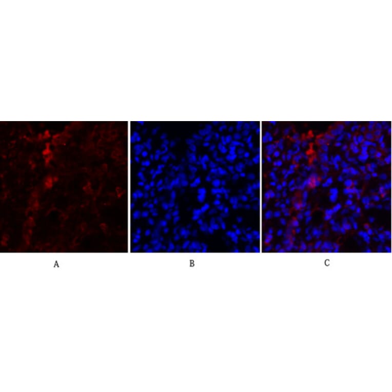 Immunofluorescence - Anti-PKM2 Antibody (R12-2313) - Antibodies.com
