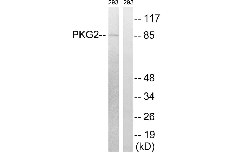 Western Blot - Anti-PKG2 Antibody (B8173) - Antibodies.com