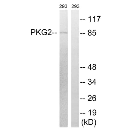 Western Blot - Anti-PKG2 Antibody (B8173) - Antibodies.com