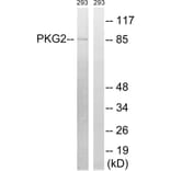 Western Blot - Anti-PKG2 Antibody (B8173) - Antibodies.com
