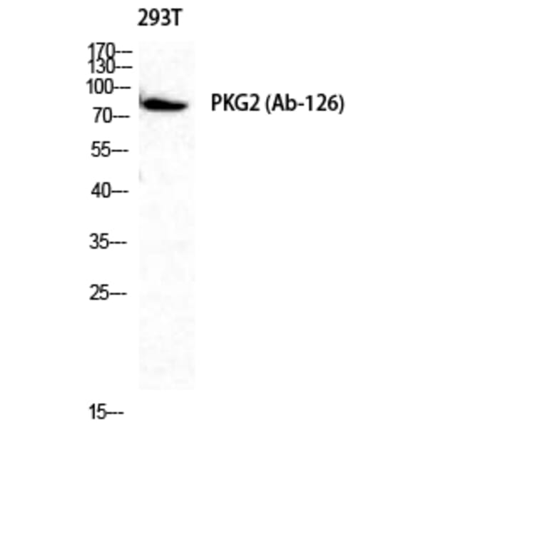 Western Blot - Anti-PKG2 Antibody (B8173) - Antibodies.com