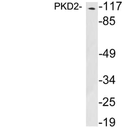 Western Blot - Anti-PKD2 Antibody (R12-2312) - Antibodies.com