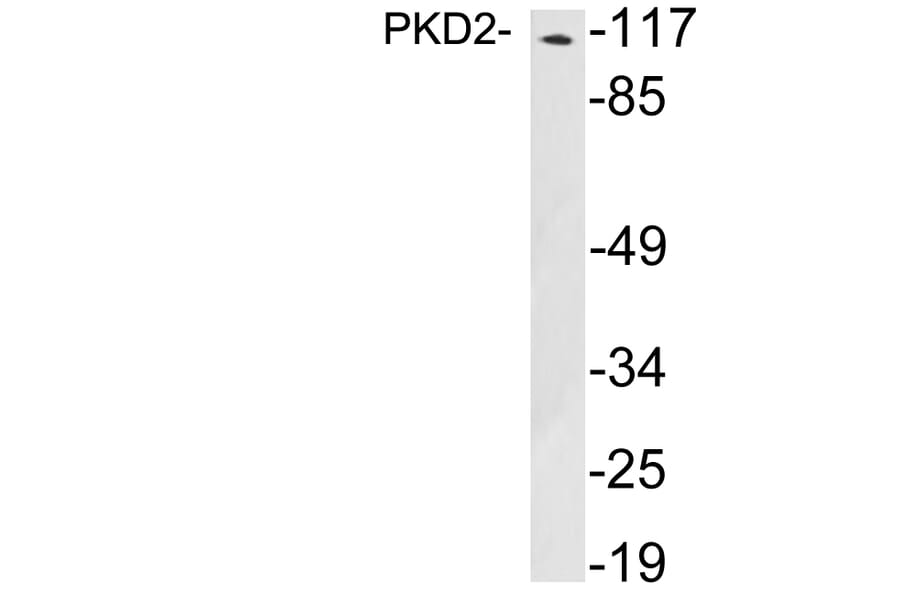 Western Blot - Anti-PKD2 Antibody (R12-2312) - Antibodies.com