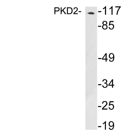 Western Blot - Anti-PKD2 Antibody (R12-2312) - Antibodies.com