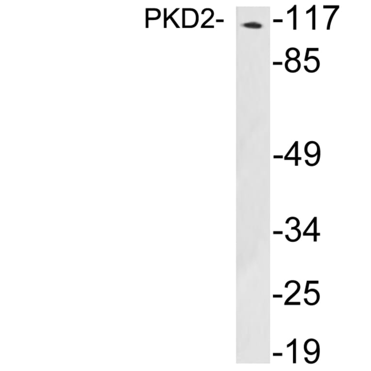Western Blot - Anti-PKD2 Antibody (R12-2312) - Antibodies.com