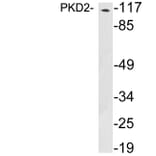Western Blot - Anti-PKD2 Antibody (R12-2312) - Antibodies.com