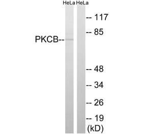 Western Blot - Anti-PKCB Antibody (B8169) - Antibodies.com