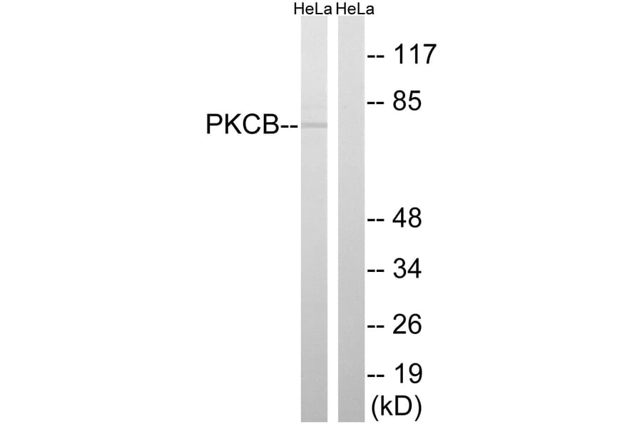 Western Blot - Anti-PKCB Antibody (B8169) - Antibodies.com