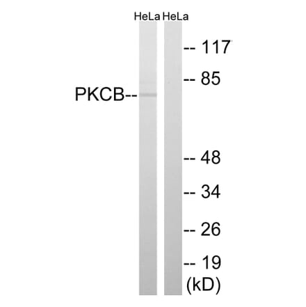 Western Blot - Anti-PKCB Antibody (B8169) - Antibodies.com