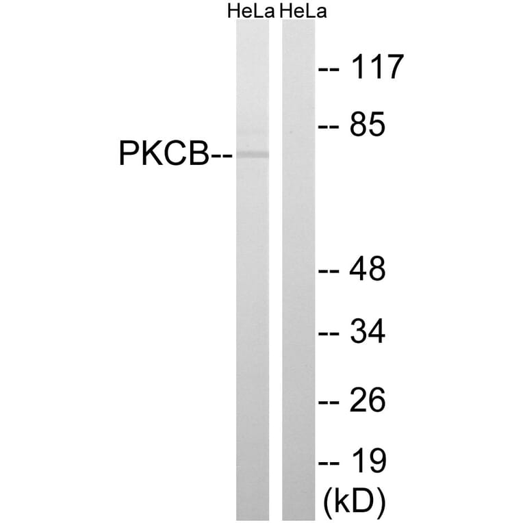 Western Blot - Anti-PKCB Antibody (B8169) - Antibodies.com