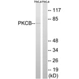 Western Blot - Anti-PKCB Antibody (B8169) - Antibodies.com