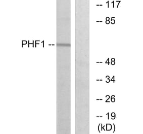 Western Blot - Anti-PHF1 Antibody (C10090) - Antibodies.com