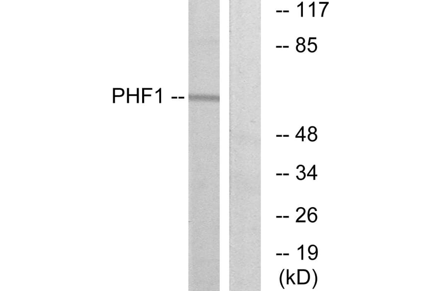 Western Blot - Anti-PHF1 Antibody (C10090) - Antibodies.com