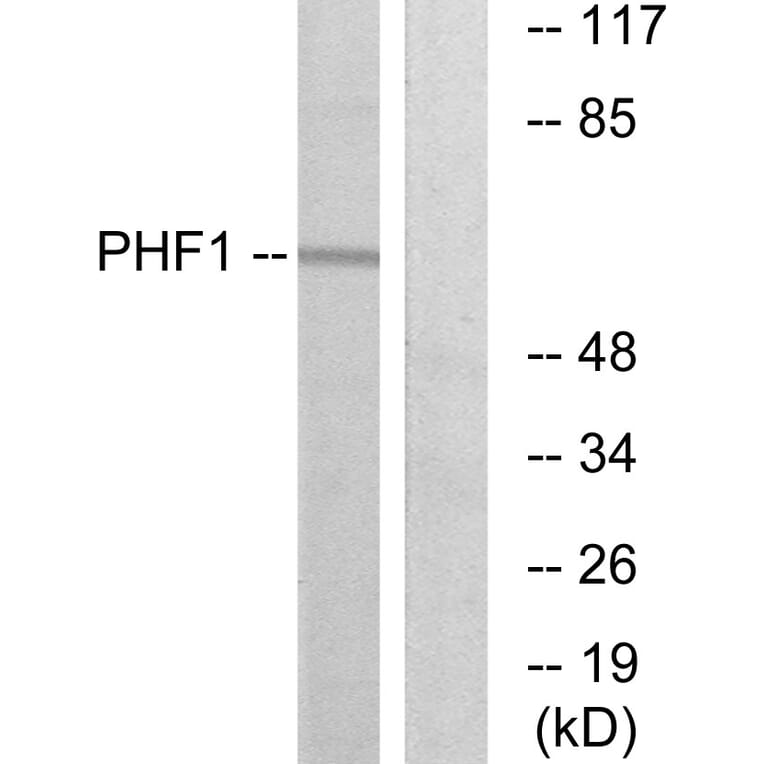 Western Blot - Anti-PHF1 Antibody (C10090) - Antibodies.com