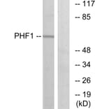 Western Blot - Anti-PHF1 Antibody (C10090) - Antibodies.com