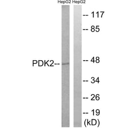Western Blot - Anti-PDK2 Antibody (C18101) - Antibodies.com