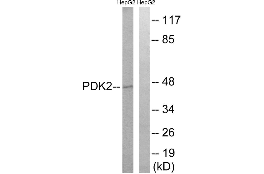 Western Blot - Anti-PDK2 Antibody (C18101) - Antibodies.com