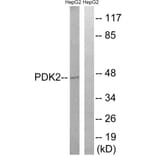 Western Blot - Anti-PDK2 Antibody (C18101) - Antibodies.com