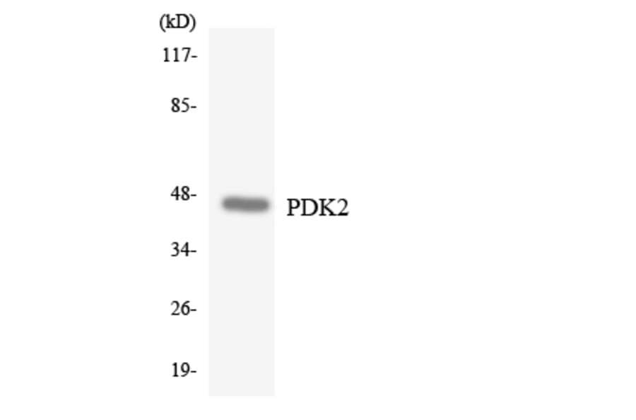 Western Blot - Anti-PDK2 Antibody (R12-3309) - Antibodies.com