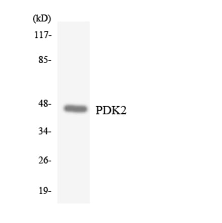 Western Blot - Anti-PDK2 Antibody (R12-3309) - Antibodies.com