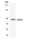 Western Blot - Anti-PDK2 Antibody (R12-3309) - Antibodies.com