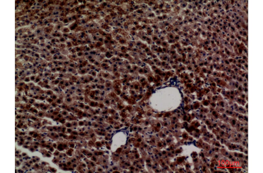 Immunohistochemistry - Anti-PCK1 Antibody (C30306) - Antibodies.com