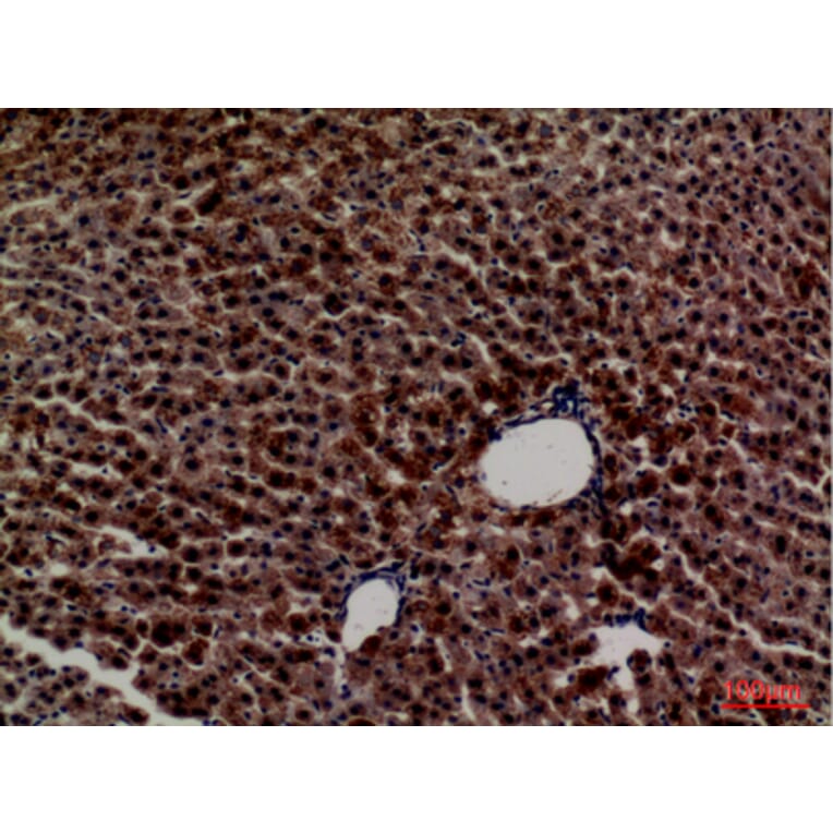 Immunohistochemistry - Anti-PCK1 Antibody (C30306) - Antibodies.com