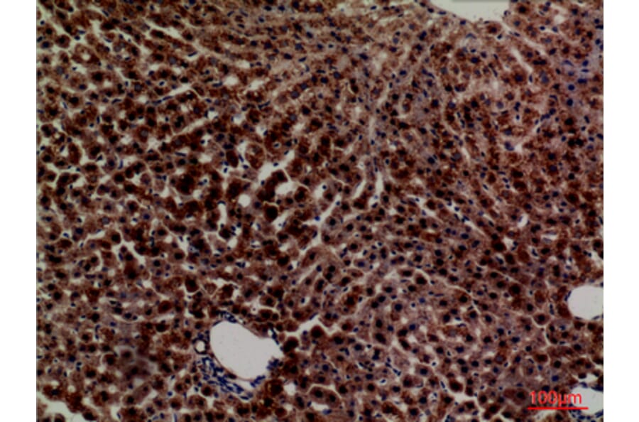 Immunohistochemistry - Anti-PCK1 Antibody (C30306) - Antibodies.com
