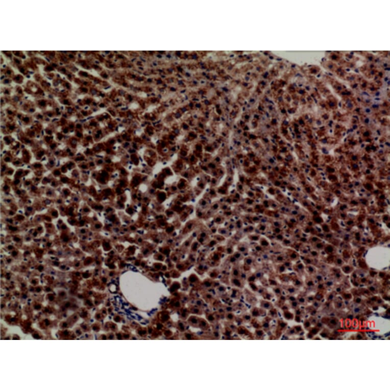 Immunohistochemistry - Anti-PCK1 Antibody (C30306) - Antibodies.com