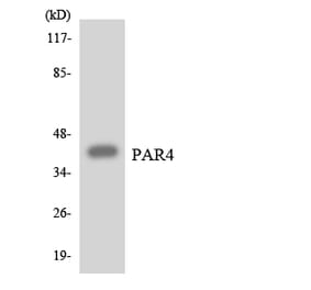 Western Blot - Anti-PAR4 Antibody (R12-3301) - Antibodies.com