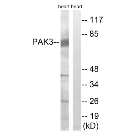 Western Blot - Anti-PAK3 Antibody (B8163) - Antibodies.com