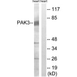 Western Blot - Anti-PAK3 Antibody (B8163) - Antibodies.com