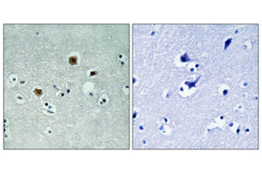 Immunohistochemistry - Anti-PAK3 Antibody (B8163) - Antibodies.com