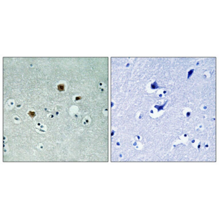 Immunohistochemistry - Anti-PAK3 Antibody (B8163) - Antibodies.com