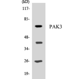 Western Blot - Anti-PAK3 Antibody (R12-3299) - Antibodies.com