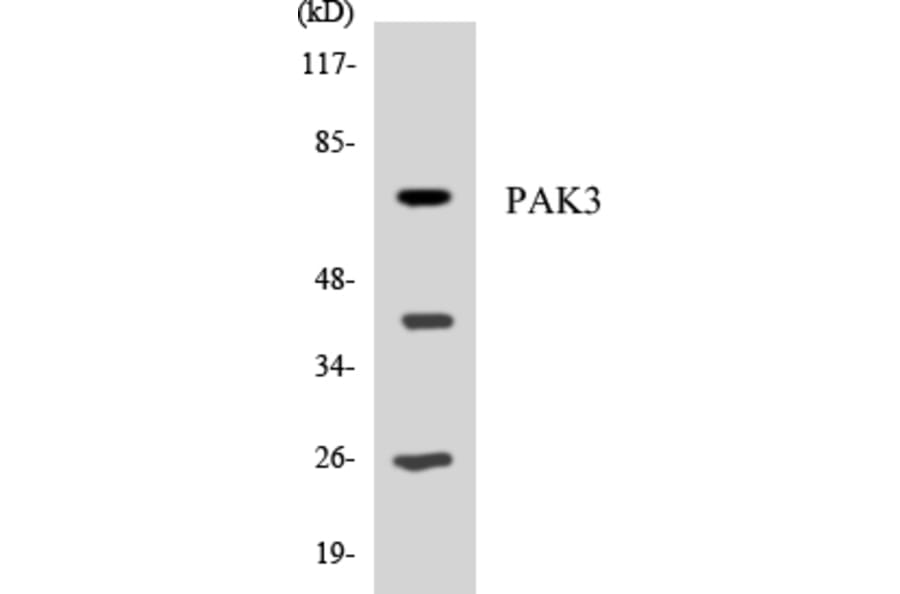 Western Blot - Anti-PAK3 Antibody (R12-3299) - Antibodies.com