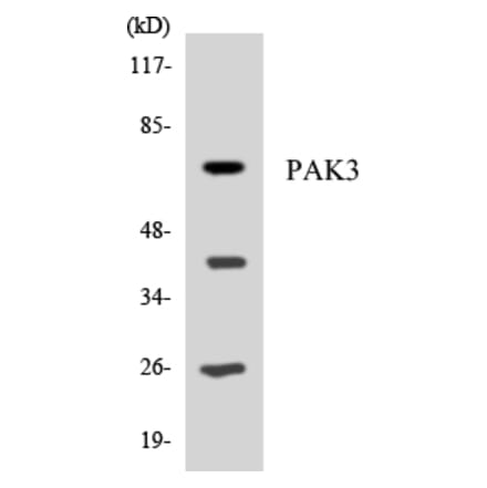Western Blot - Anti-PAK3 Antibody (R12-3299) - Antibodies.com