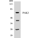 Western Blot - Anti-PAK3 Antibody (R12-3299) - Antibodies.com