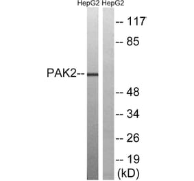 Western Blot - Anti-PAK2 Antibody (B8160) - Antibodies.com