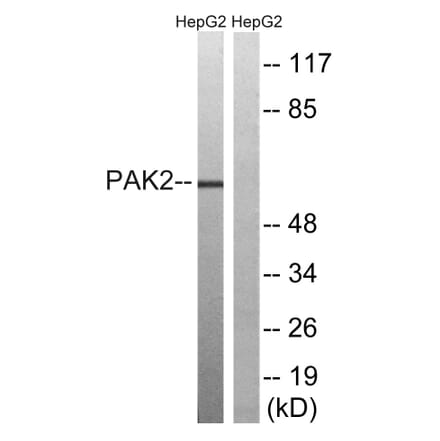 Western Blot - Anti-PAK2 Antibody (B8160) - Antibodies.com