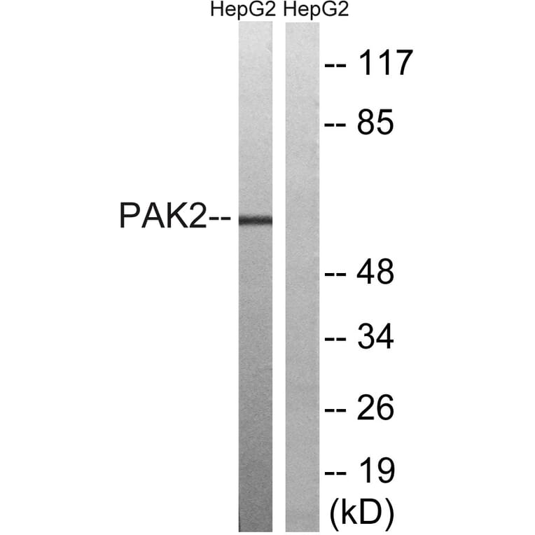 Western Blot - Anti-PAK2 Antibody (B8160) - Antibodies.com