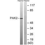 Western Blot - Anti-PAK2 Antibody (B8160) - Antibodies.com